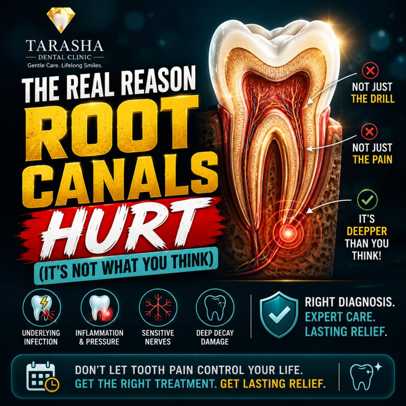 Painless root canal treatment at Tarasha Dental Clinic, Lajpat Nagar South Delhi