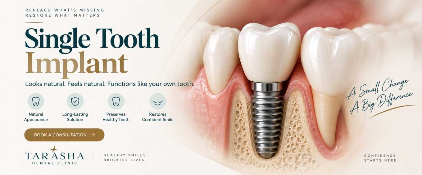 Single Tooth Implant in Delhi: A Natural Way to Replace One Missing Tooth